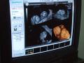 Gravidele din Oradea au posibilitatea să facă ecografii 4D gratuit, la Maternitate
