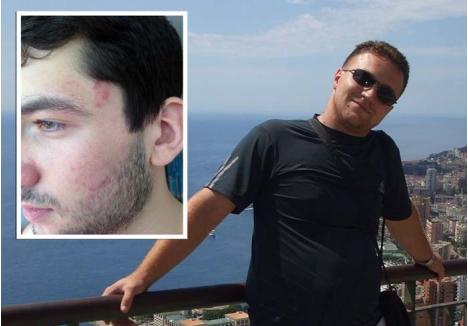 "MĂ PIŞ PE TINE!". Aşa i-ar fi spus agentul principal Ştefan Morlocan (foto) studentului Victor Mîndru, chiar în sediul Poliţiei, după ce îl lovise cu palmele, îl scuipase şi îi spusese să dispară "în Rusia". Medicii au stabilit că tânărul a avut nevoie de 4 zile de îngrijiri, însă amintirea scuipatului de pe obraji nu poate fi ştearsă de niciun tratament