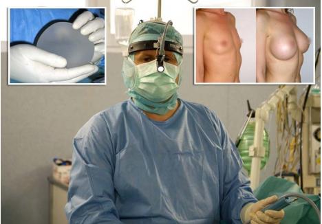FĂRĂ URME. Cele mai căutate intervenţii pe care doctorul Şerban Porumb (foto) le face la propria-i clinică, Estetis, sunt cele de mărire a sânilor cu implant mamar prin axilă, adică printr-o tăietură la subraţ, ale căror urme sunt aproape invizibile