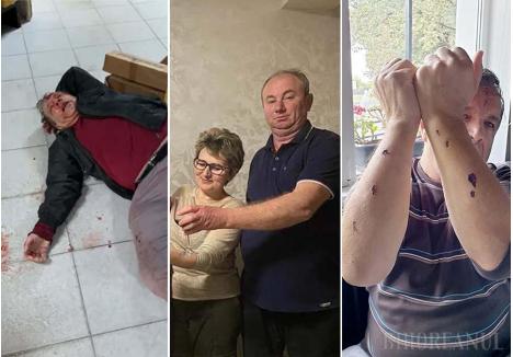 foto arhivă BIHOREANUL: Fostul procuror Ioan Bodogai, bătut crunt de primărița Livia Bârlău și soțul ei, a avut nevoie de 100 zile de îngrijiri medicale