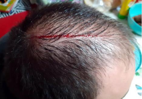Un localnic din Borş s-a ales cu o rană serioasă în cap, după ce a fost atacat de şorecarul din cimitir
