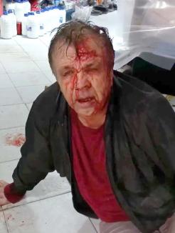 'Răsplătit' cu sânge: Povestea şocantă a fostului procuror bătut sălbatic de soţul primăriţei din Brusturi (FOTO / VIDEO)