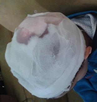 De la grădi, la spital: Un copil şi-a spart capul la grădiniţa din Sânmartin, iar educatoarea n-a chemat un medic