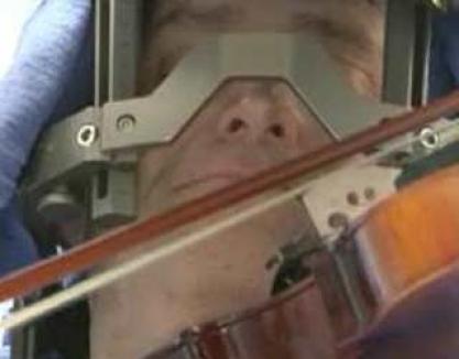 Cântă la vioară în timpul unei operaţii pe creier! (VIDEO)