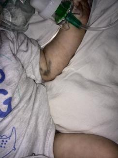 Un bebeluş de 7 luni, bolnav de rujeolă, este în stare gravă la Spitalul Municipal din Oradea. Părinţii acuză doctorii că ar fi ascuns riscul de îmbolnăvire (FOTO)