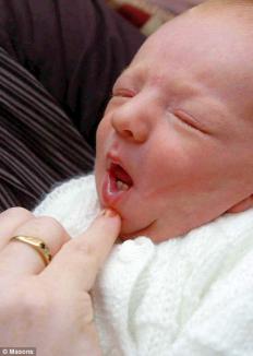 Un bebe s-a născut cu doi dinţişori