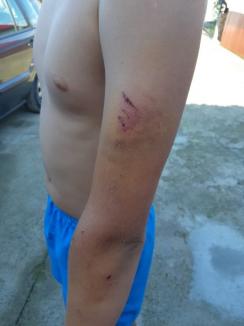 Un adolescent de 15 ani a ajuns la spital cu urechea sfâşiată după ce a fost atacat de rottweileri. Proprietarul câinilor a fugit de la locul incidentului (FOTO)