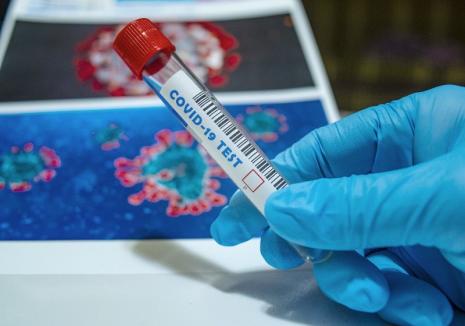 Coronavirus în Bihor: 81 de cazuri active vineri dimineaţă. Procentul vindecaţilor: 82,92%