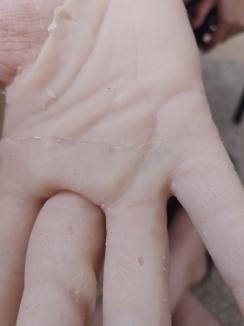 O mână de ajutor: Un tânăr din Bihor rămas fără degete va primi o mănușă bionică creată de un inginer orădean (FOTO/VIDEO)