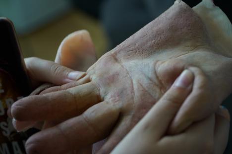 O mână de ajutor: Un tânăr din Bihor rămas fără degete va primi o mănușă bionică creată de un inginer orădean (FOTO/VIDEO)