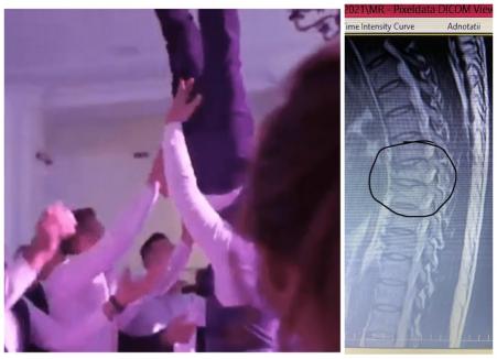 Mire vs. invitaţi: Un tânăr din Bihor, scăpat de prieteni din braţe la nunta sa, i-a dat în judecată şi le cere daune de 20.000 euro (VIDEO)