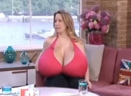 Femeia cu sâni care cresc necontrolat (VIDEO)