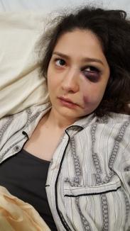 Bătaie în pasajul Vulturul Negru: O tânără a ajuns la spital, bătută de doi bărbaţi pe care ea şi prietena ei i-au refuzat (FOTO)