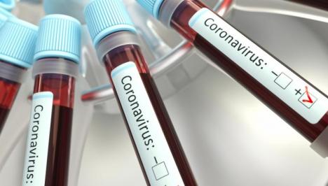 'Scenariul doi': 29 de cazuri de coronavirus, confirmate în România