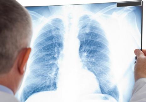 Ce este tuberculoza și cum te poți păzi de ea