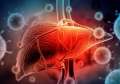 Afecţiunile ficatului: hepatita cronică