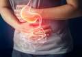 Ulcerul duodenal: ce îl provoacă şi care sunt primele semne?