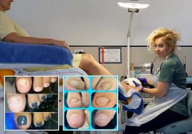 Pași fără durere: Un salon modern de pedichiură medicală din Oradea oferă soluții pentru problemele picioarelor (FOTO)