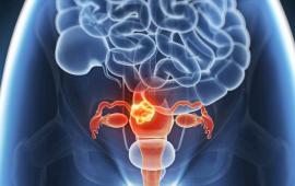 Cancerul de col uterin şi infecţia cu HPV