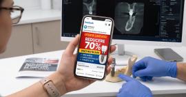 7 lucruri pe care trebuie să le știi înainte de primul implant dentar